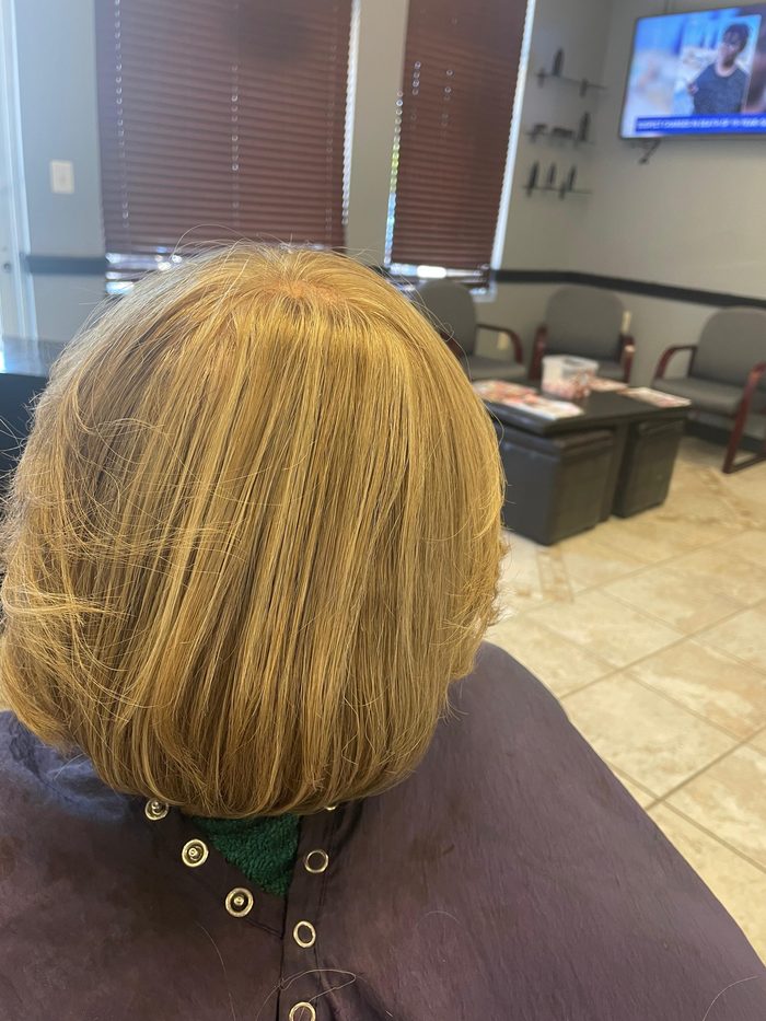 Client 1 after hair restoration