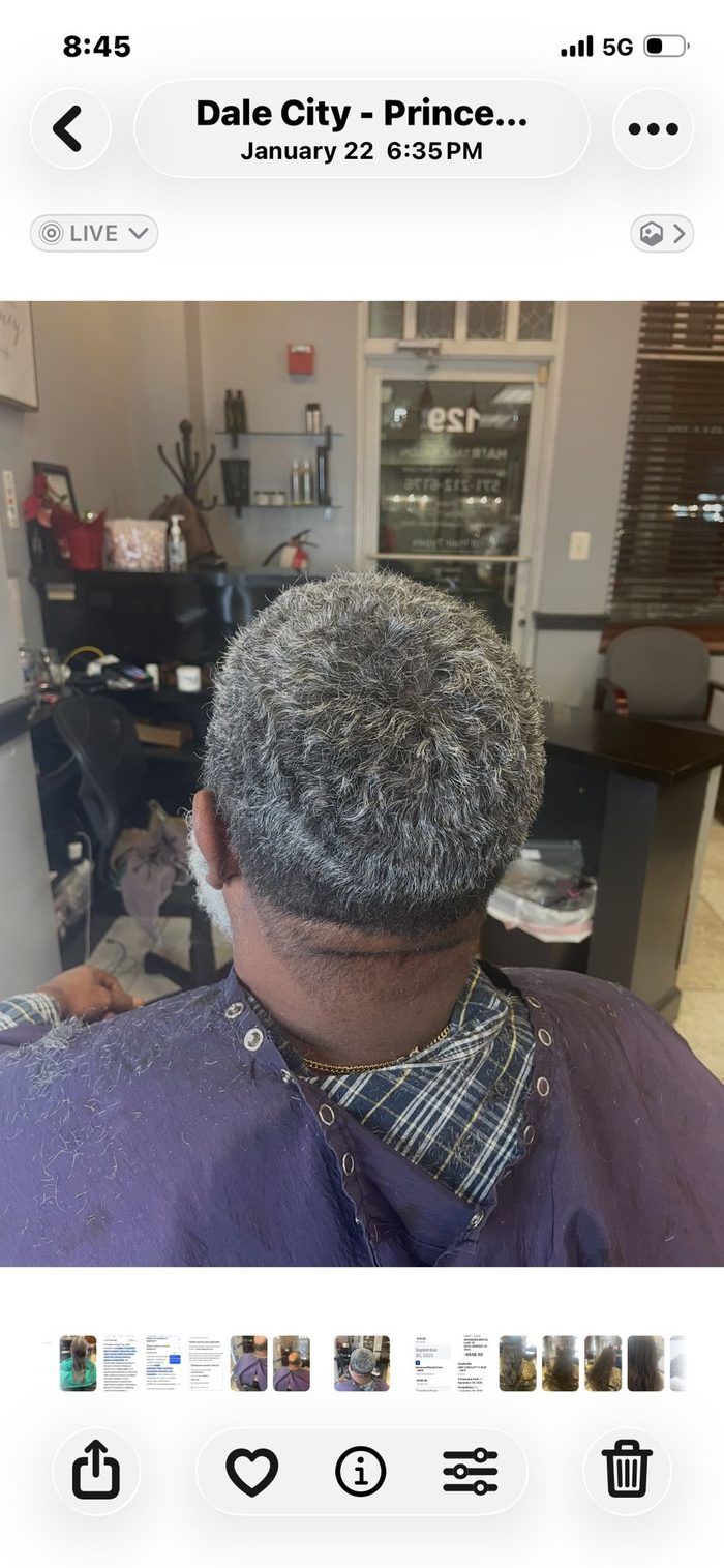 Client 3 after hair restoration