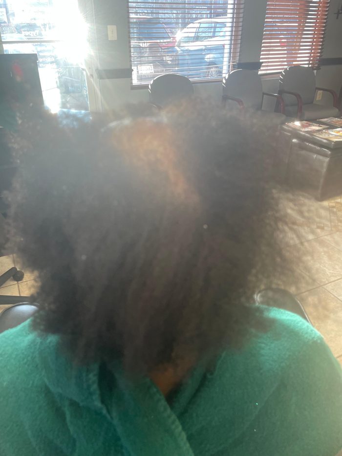 Client 5 before hair restoration